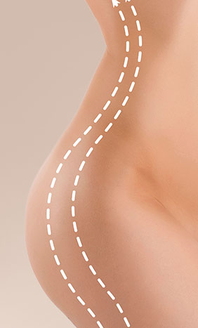 Body & After-Weight Loss Contouring